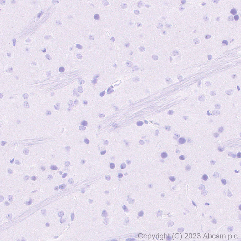 Immunohistochemistry (Formalin/PFA-fixed paraffin-embedded sections) - Anti-Loricrin antibody [RM1090] - BSA and Azide free (AB315353)
