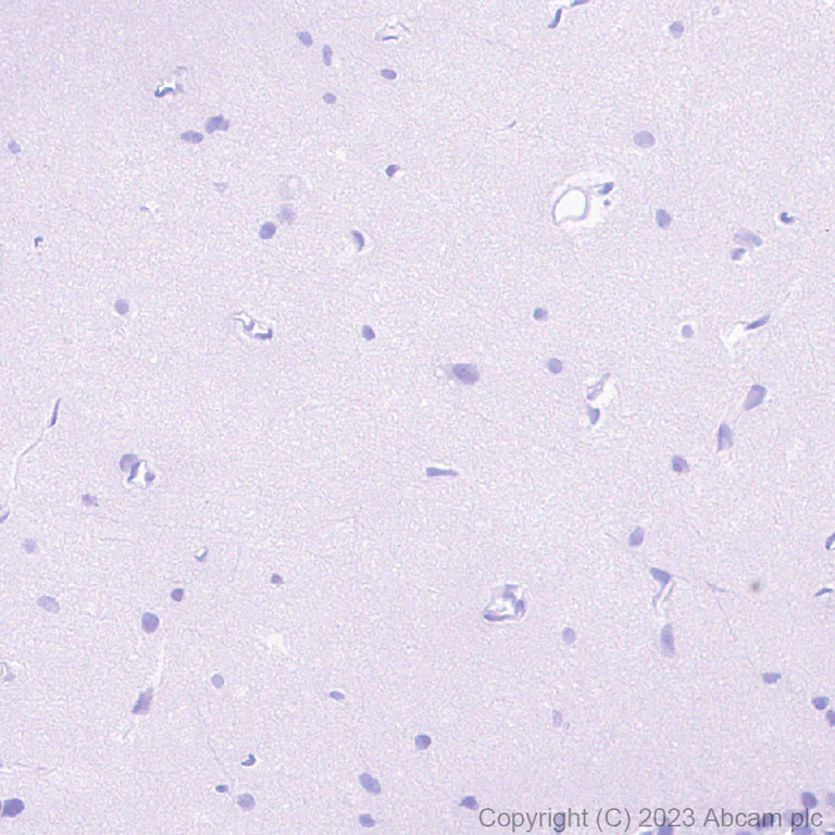 Immunohistochemistry (Formalin/PFA-fixed paraffin-embedded sections) - Anti-Loricrin antibody [RM1090] - BSA and Azide free (AB315353)