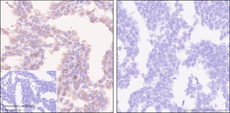 Immunohistochemistry (Formalin/PFA-fixed paraffin-embedded sections) - Anti-Loricrin antibody [RM1090] - BSA and Azide free (AB315353)