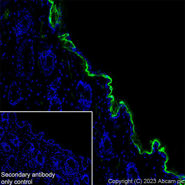 Immunohistochemistry (Frozen sections) - Anti-Loricrin antibody [RM1090] - BSA and Azide free (AB315353)