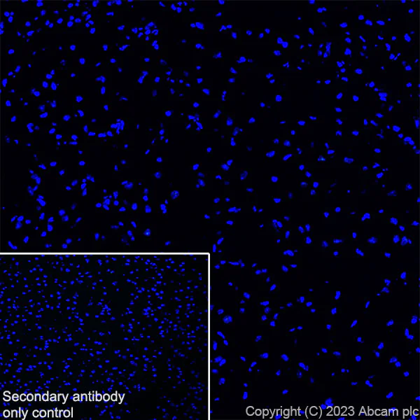 Immunohistochemistry (Frozen sections) - Anti-Loricrin antibody [RM1090] - BSA and Azide free (AB315353)