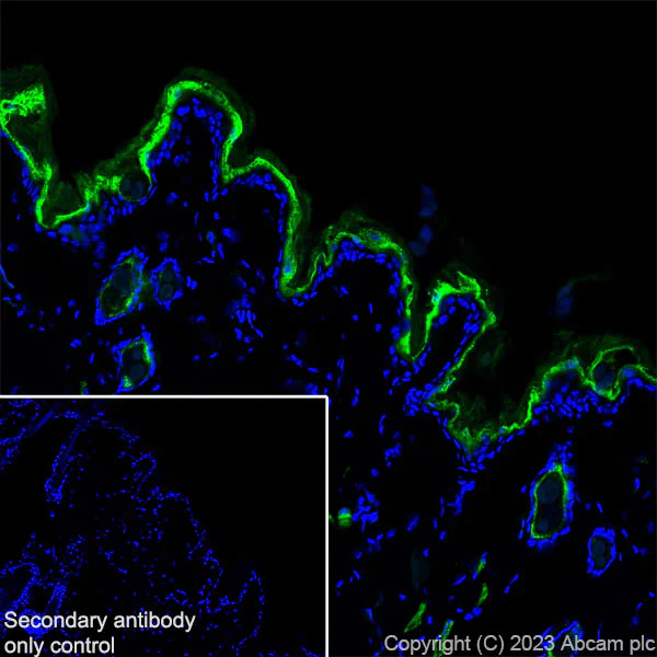 Immunohistochemistry (Frozen sections) - Anti-Loricrin antibody [RM1090] - BSA and Azide free (AB315353)