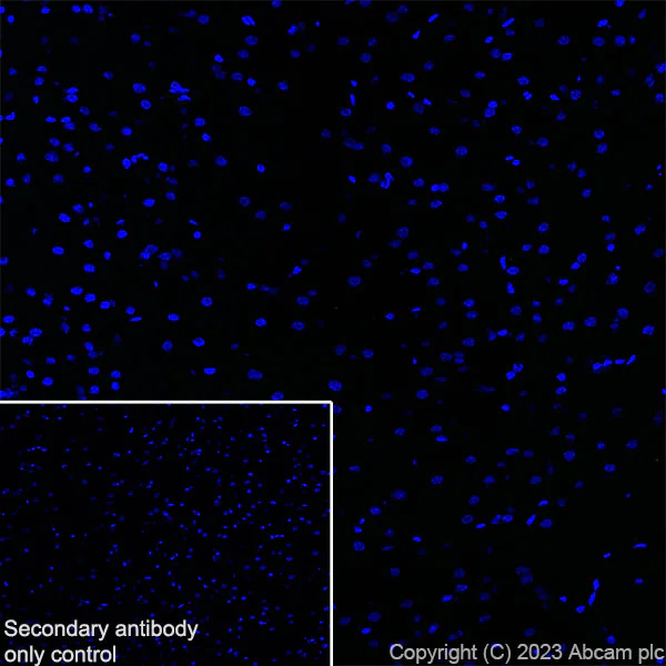 Immunohistochemistry (Frozen sections) - Anti-Loricrin antibody [RM1090] - BSA and Azide free (AB315353)