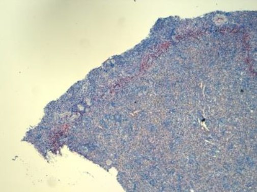 Immunohistochemistry (Formalin/PFA-fixed paraffin-embedded sections) - Anti-LOX 1 antibody [23C11] (AB81709), expandable thumbnail