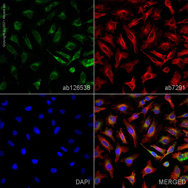 Anti-LOX 1 antibody. Rabbit polyclonal (ab126538) | Abcam