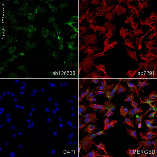 Immunocytochemistry/ Immunofluorescence - Anti-LOX 1 antibody (AB126538)