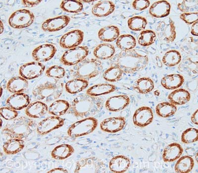 Immunohistochemistry (Formalin/PFA-fixed paraffin-embedded sections) - Anti-LOX 1 antibody (AB126538)