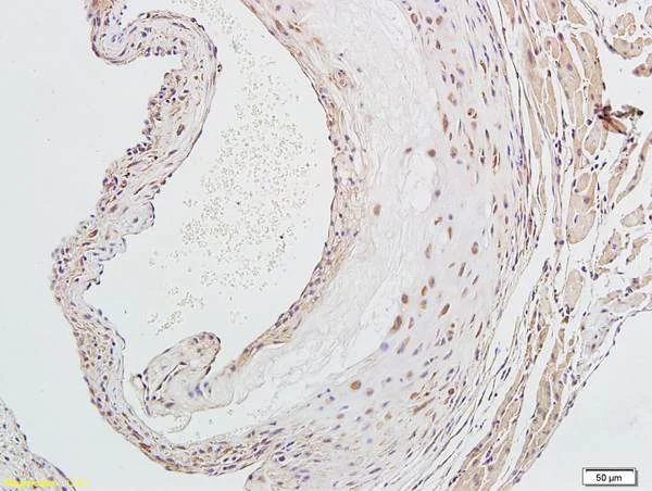 Immunohistochemistry (Formalin/PFA-fixed paraffin-embedded sections) - Anti-LOX 1 antibody - C-terminal (AB203246)