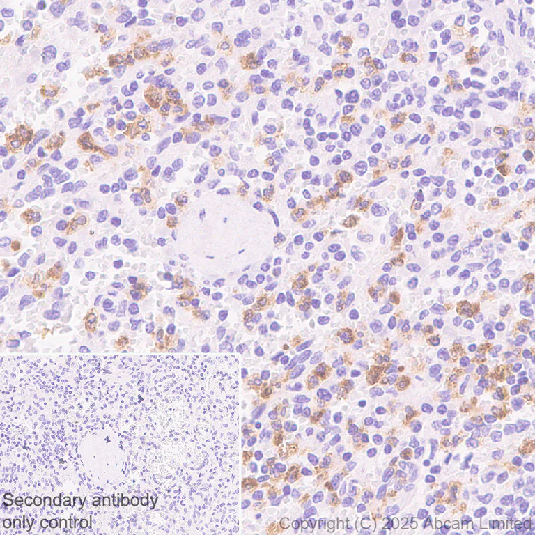 Immunohistochemistry (Formalin/PFA-fixed paraffin-embedded sections) - Anti-LOX 1 antibody [EPR27185-134] (AB325339)