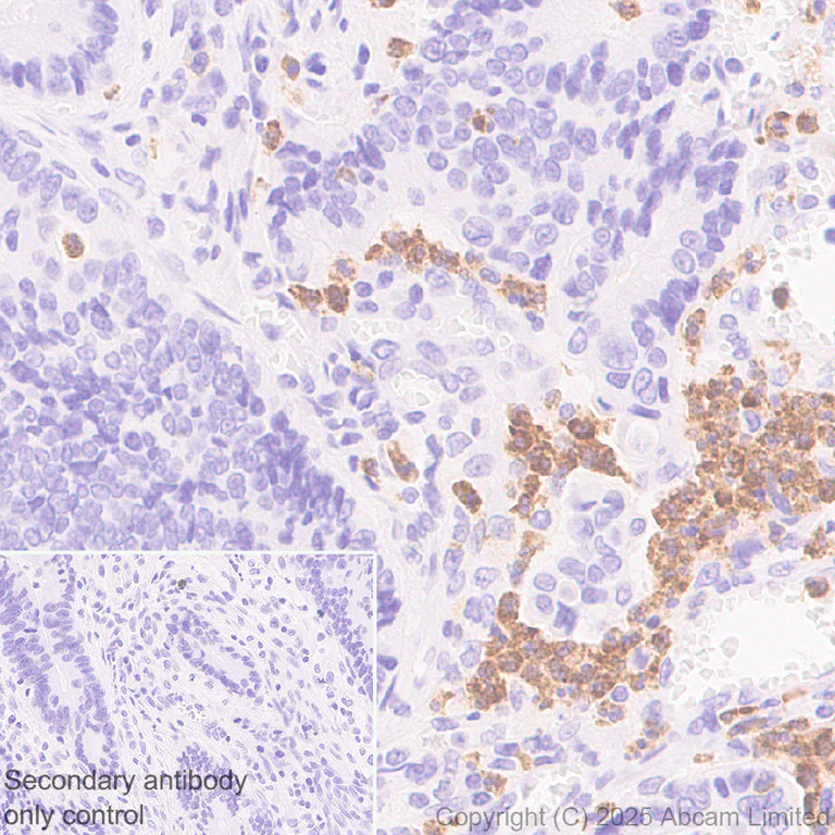 Immunohistochemistry (Formalin/PFA-fixed paraffin-embedded sections) - Anti-LOX 1 antibody [EPR27185-134] (AB325339)