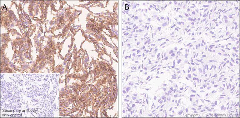Immunohistochemistry (Formalin/PFA-fixed paraffin-embedded sections) - Anti-LOX 1 antibody [EPR27185-134] (AB325339)