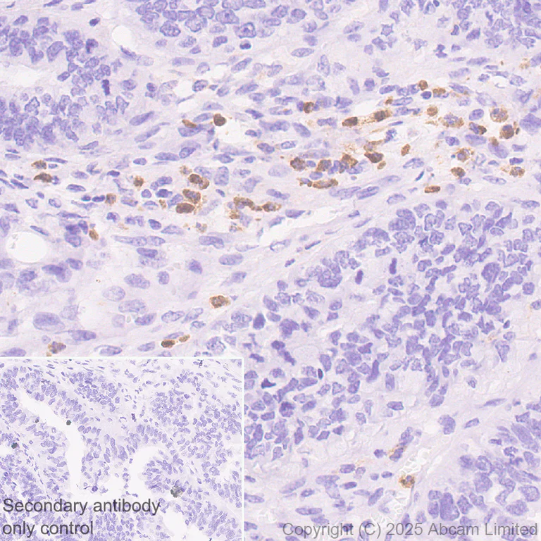 Immunohistochemistry (Formalin/PFA-fixed paraffin-embedded sections) - Anti-LOX 1 antibody [EPR27185-134] - BSA and Azide free (AB325349)
