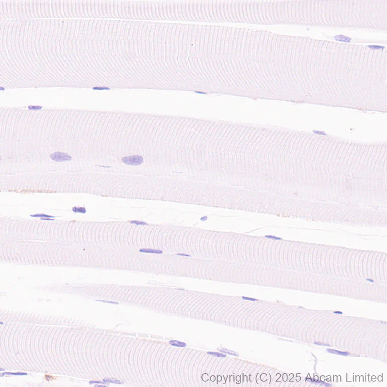 Immunohistochemistry (Formalin/PFA-fixed paraffin-embedded sections) - Anti-LOX 1 antibody [EPR27185-134] - BSA and Azide free (AB325349)