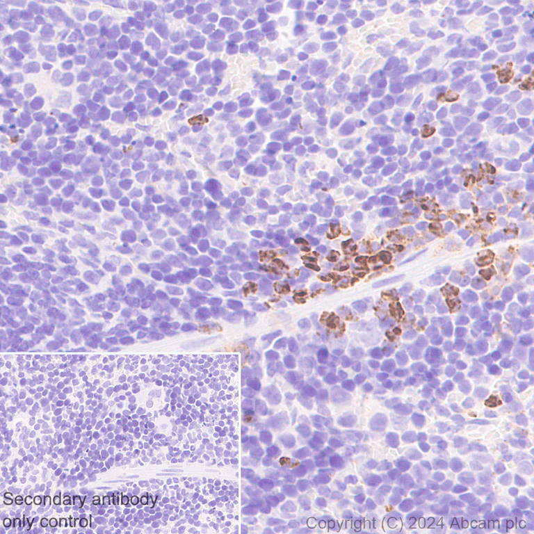 Immunohistochemistry (Formalin/PFA-fixed paraffin-embedded sections) - Anti-LOX 1 antibody [EPR27871-67] (AB317689)