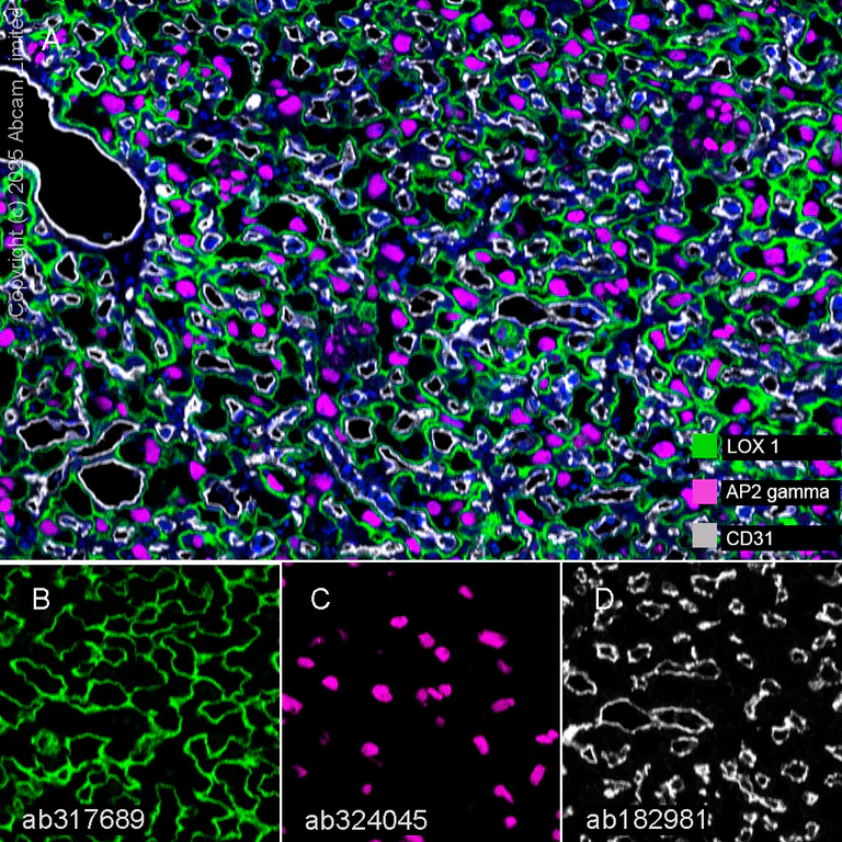 Multiplex immunohistochemistry - Anti-LOX 1 antibody [EPR27871-67] (AB317689)
