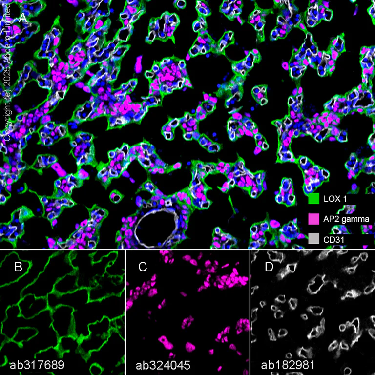 Multiplex immunohistochemistry - Anti-LOX 1 antibody [EPR27871-67] (AB317689)