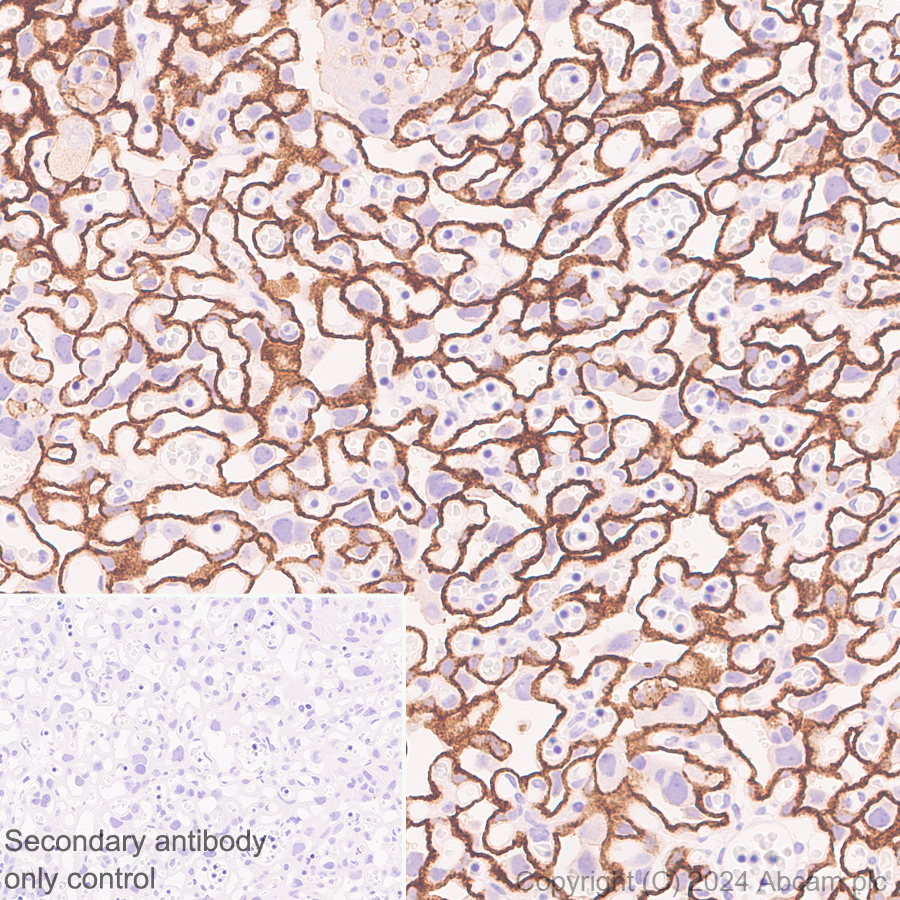 Immunohistochemistry (Formalin/PFA-fixed paraffin-embedded sections) - Anti-LOX 1 antibody [EPR27871-67] - BSA and Azide free (ab317690), expandable thumbnail