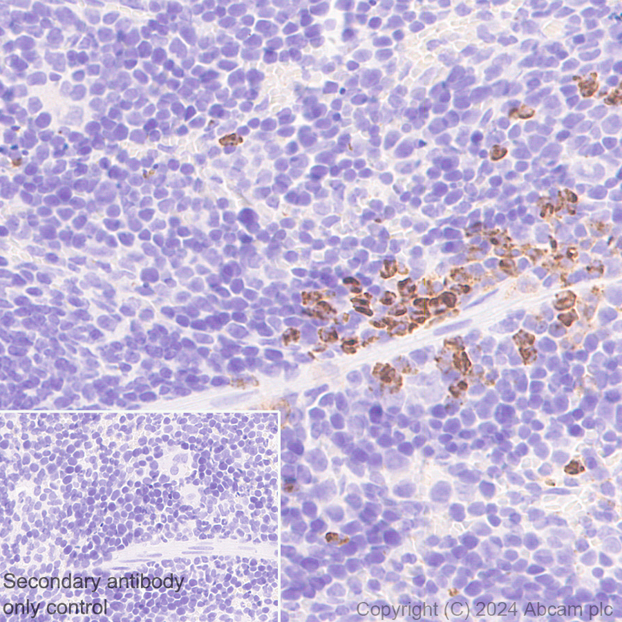 Immunohistochemistry (Formalin/PFA-fixed paraffin-embedded sections) - Anti-LOX 1 antibody [EPR27871-67] - BSA and Azide free (AB317690), expandable thumbnail