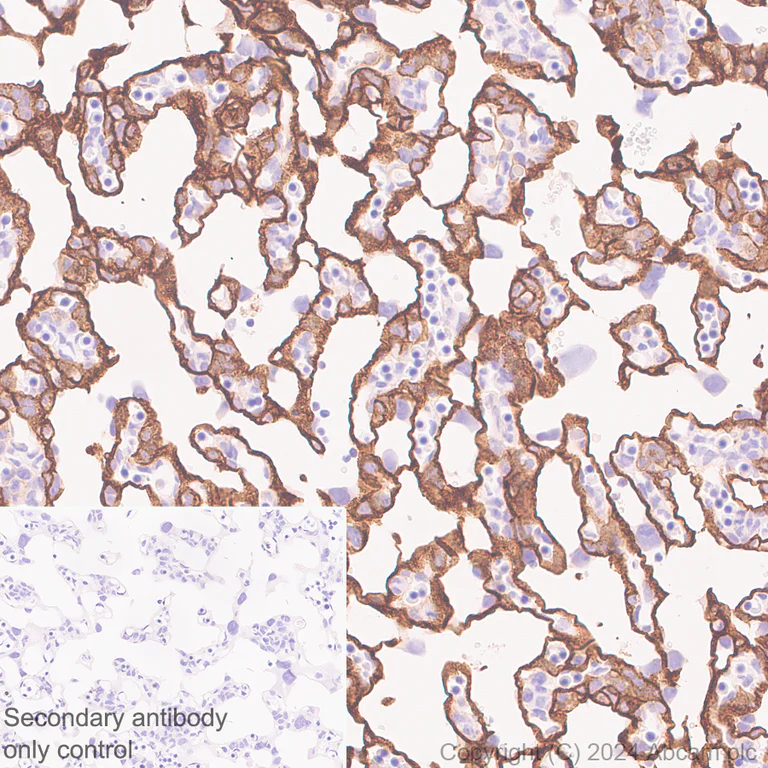 Immunohistochemistry (Formalin/PFA-fixed paraffin-embedded sections) - Anti-LOX 1 antibody [EPR27871-67] - BSA and Azide free (AB317690)