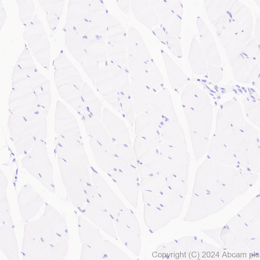 Immunohistochemistry (Formalin/PFA-fixed paraffin-embedded sections) - Anti-LOX 1 antibody [EPR27871-67] - BSA and Azide free (AB317690), expandable thumbnail