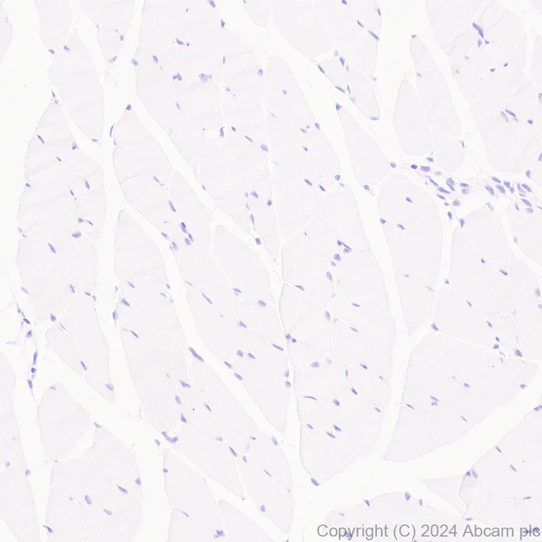 Immunohistochemistry (Formalin/PFA-fixed paraffin-embedded sections) - Anti-LOX 1 antibody [EPR27871-67] - BSA and Azide free (AB317690)
