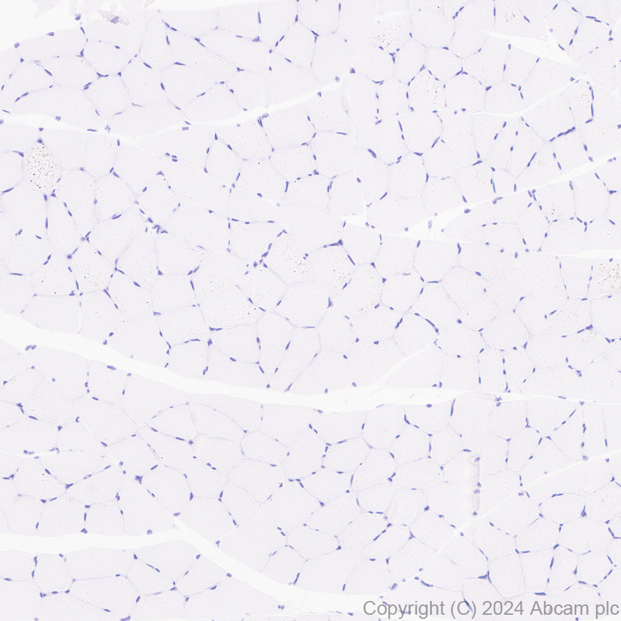 Immunohistochemistry (Formalin/PFA-fixed paraffin-embedded sections) - Anti-LOX 1 antibody [EPR27871-67] - BSA and Azide free (AB317690), expandable thumbnail