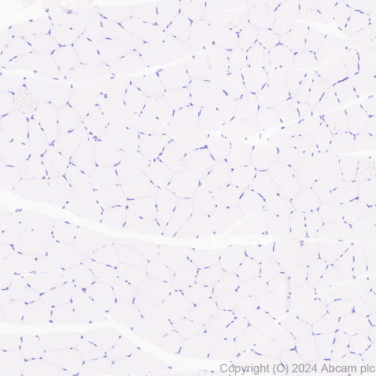 Immunohistochemistry (Formalin/PFA-fixed paraffin-embedded sections) - Anti-LOX 1 antibody [EPR27871-67] - BSA and Azide free (AB317690)