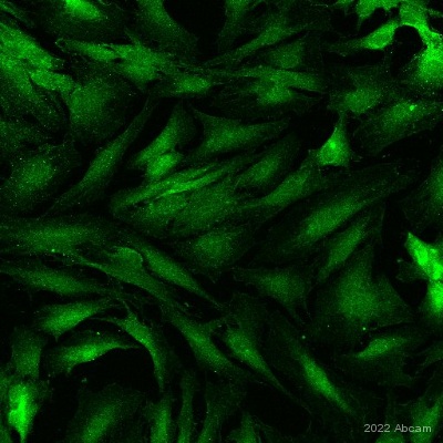 Immunocytochemistry/ Immunofluorescence - Anti-LOX antibody [EPR4025] (AB174316)
