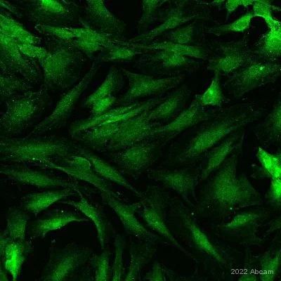 Immunocytochemistry/ Immunofluorescence - Anti-LOX antibody [EPR4025] (AB174316)