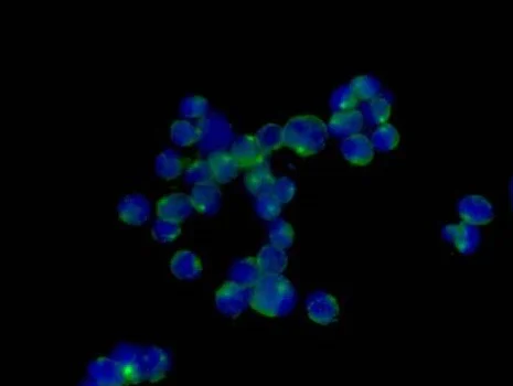Immunocytochemistry/ Immunofluorescence - Anti-LOX antibody [EPR4025] - Low endotoxin, Azide free (AB219369)