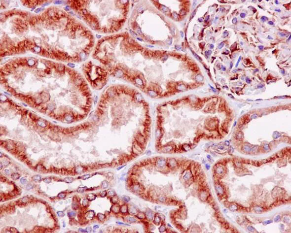 Immunohistochemistry (Formalin/PFA-fixed paraffin-embedded sections) - Anti-LOX antibody [EPR4025] - Low endotoxin, Azide free (AB219369)