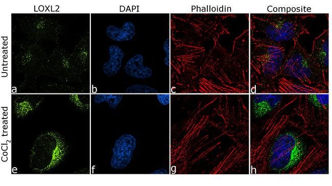 Immunocytochemistry - Anti-LOXL2 antibody [7HCLC] (AB277807)