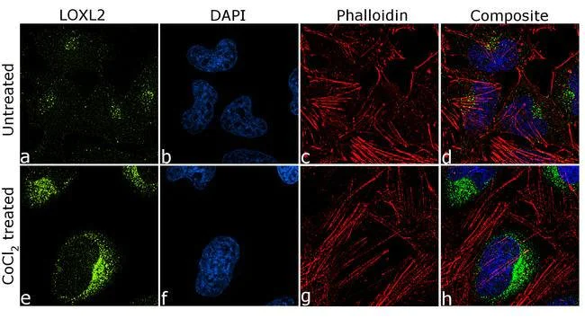 Immunocytochemistry - Anti-LOXL2 antibody [7HCLC] (AB277807)