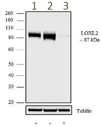 Western blot - Anti-LOXL2 antibody [7HCLC] (AB277807)