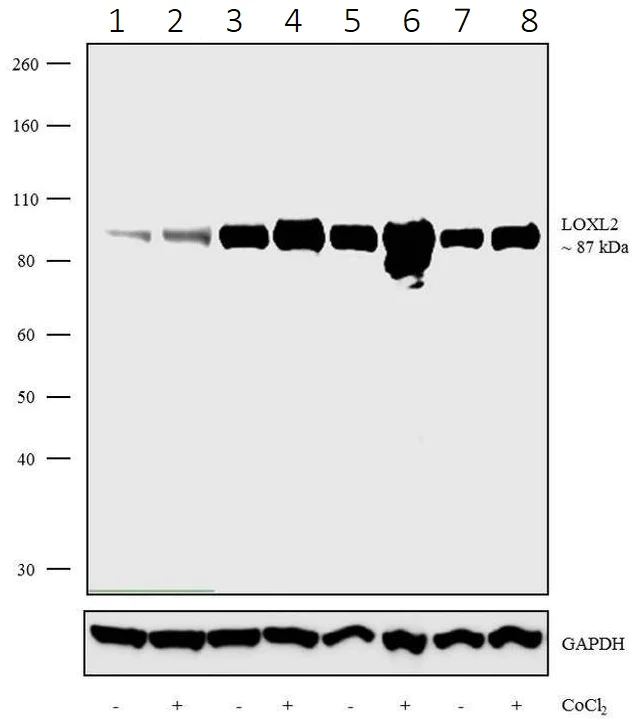 Western blot - Anti-LOXL2 antibody [7HCLC] (AB277807)