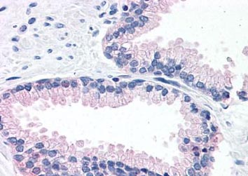 Immunohistochemistry (Formalin/PFA-fixed paraffin-embedded sections) - Anti-LOXL2 antibody (AB133383)