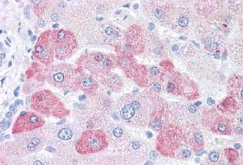 Immunohistochemistry (Formalin/PFA-fixed paraffin-embedded sections) - Anti-LOXL2 antibody (AB133383)