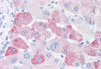 Immunohistochemistry (Formalin/PFA-fixed paraffin-embedded sections) - Anti-LOXL2 antibody (AB133383)