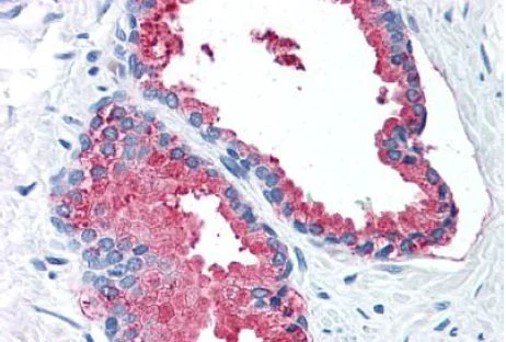 Immunohistochemistry (Formalin/PFA-fixed paraffin-embedded sections) - Anti-LOXL2 antibody (AB140833)