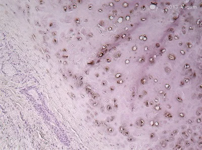Immunohistochemistry (Formalin/PFA-fixed paraffin-embedded sections) - Anti-LOXL2 antibody (AB140833)