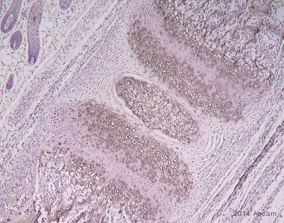 Immunohistochemistry (Formalin/PFA-fixed paraffin-embedded sections) - Anti-LOXL2 antibody (AB140833)