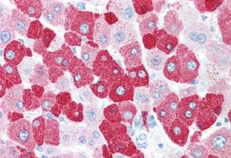 Immunohistochemistry (Formalin/PFA-fixed paraffin-embedded sections) - Anti-LOXL2 antibody (AB140833)