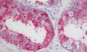 Immunohistochemistry (Formalin/PFA-fixed paraffin-embedded sections) - Anti-LOXL2 antibody (AB197779), expandable thumbnail