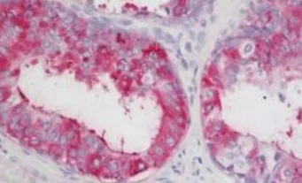 Immunohistochemistry (Formalin/PFA-fixed paraffin-embedded sections) - Anti-LOXL2 antibody (AB197779)