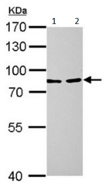 Western blot - Anti-LOXL2 antibody (AB197779), expandable thumbnail