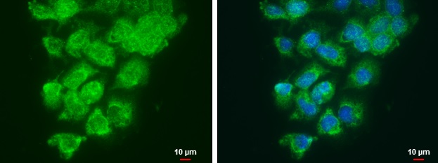 Immunocytochemistry/ Immunofluorescence - Anti-LOXL2 antibody (AB96233)