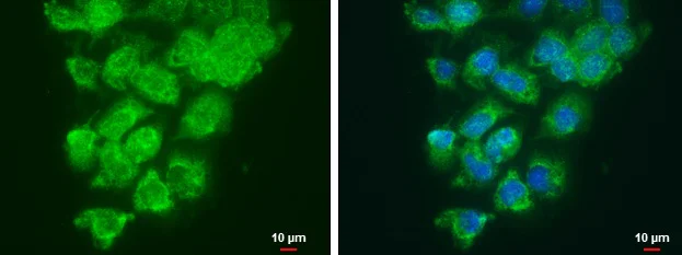 Immunocytochemistry/ Immunofluorescence - Anti-LOXL2 antibody (AB96233)