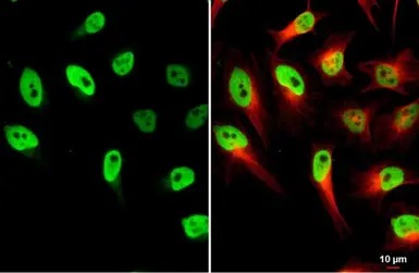 Anti-LOXL2 antibody (ab96233) | Abcam