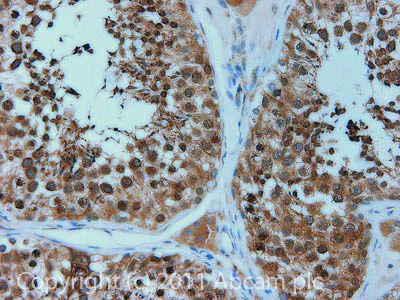 Immunohistochemistry (Formalin/PFA-fixed paraffin-embedded sections) - Anti-LOXL2 antibody (AB96233)