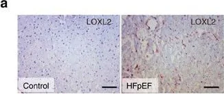 Immunohistochemistry - Anti-LOXL2 antibody (AB96233)